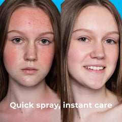 PatchRx HOCL spray applied to face and body for gentle cleansing.