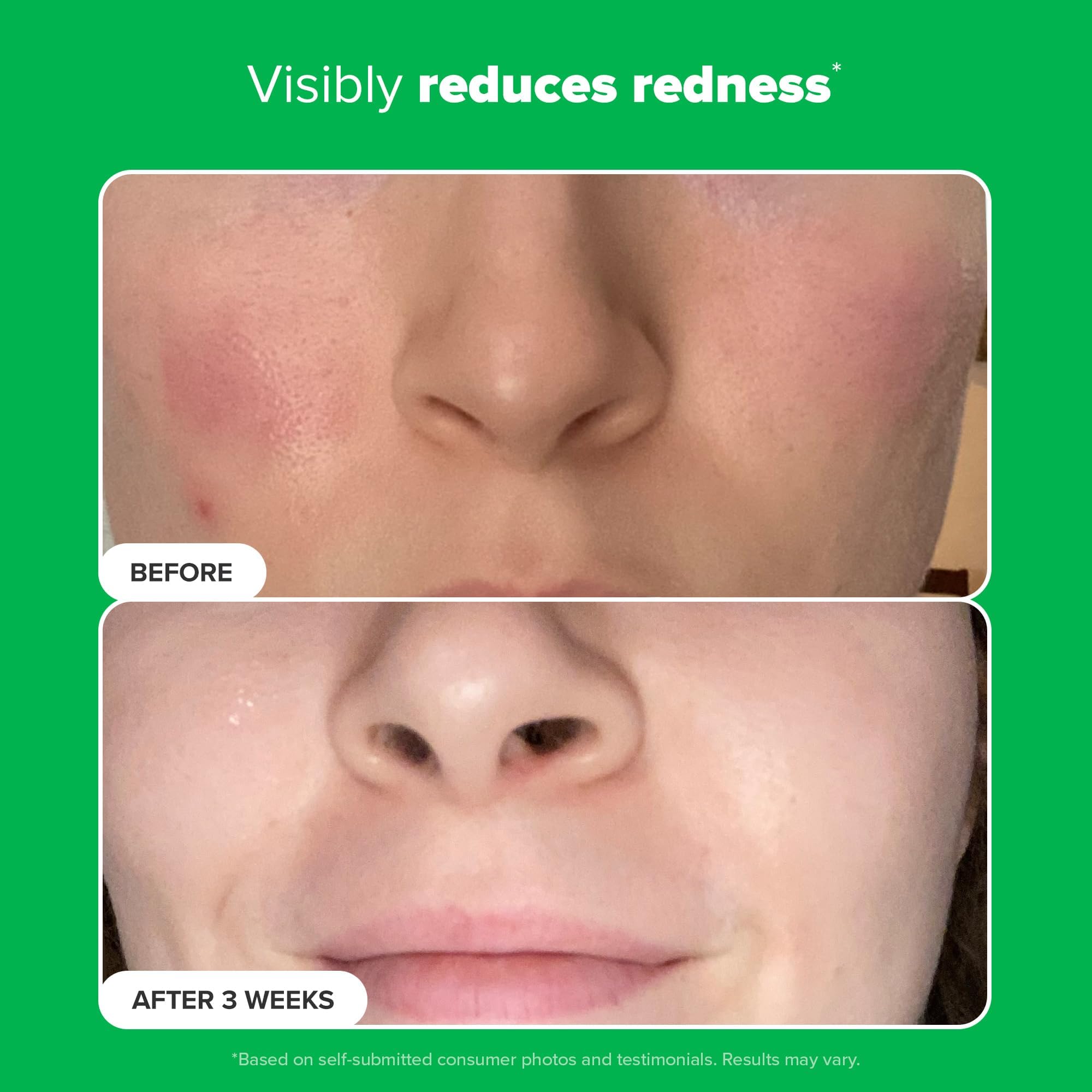Paula's Choice BOOST fragrance-free label emphasizes clean skincare.
