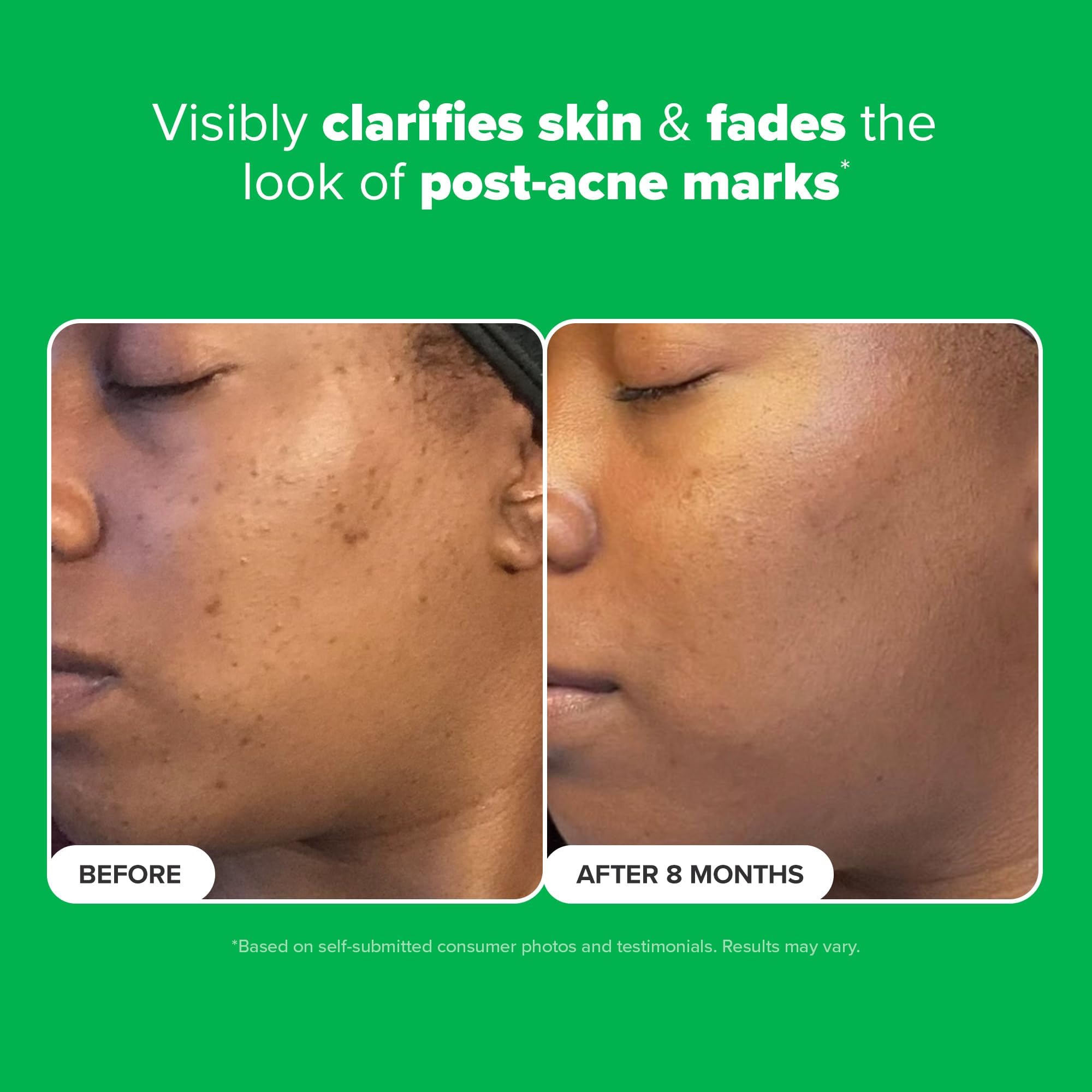 Paula's Choice BOOST azelaic acid gel swatch shows quick absorption.