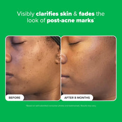 Paula's Choice BOOST azelaic acid gel swatch shows quick absorption.
