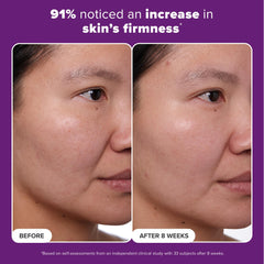 Peptides provide skin firmness in Paula's Choice Clinical 1% Retinol formula.