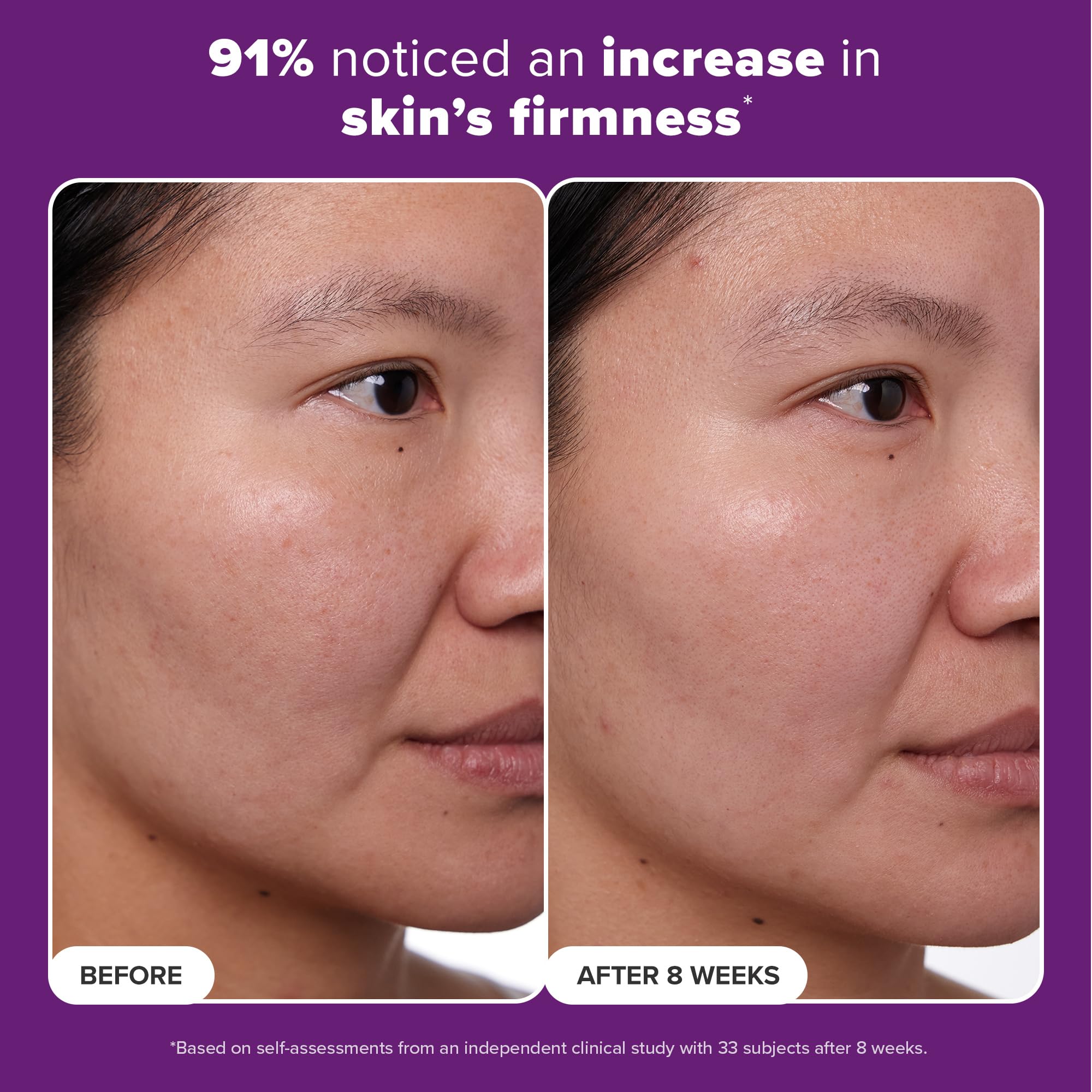 Paula's Choice Clinical 1% Retinol skin firming and subtle lifting