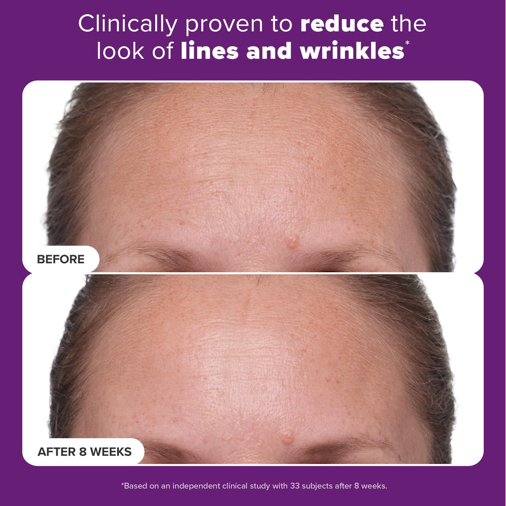 Paula's Choice CLINICAL 1% Retinol with vitamin C and licorice brightens and evens tone