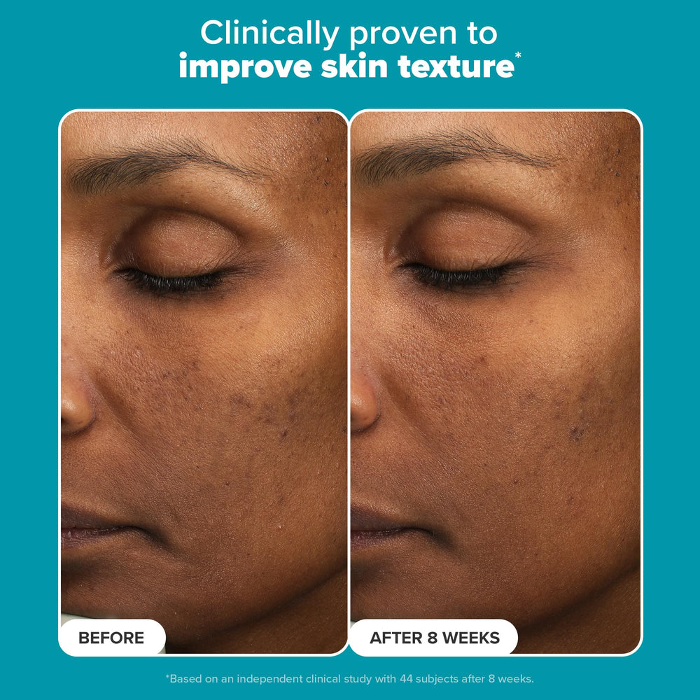 Paula's Choice exfoliant on skin demonstrates glow and smoother texture