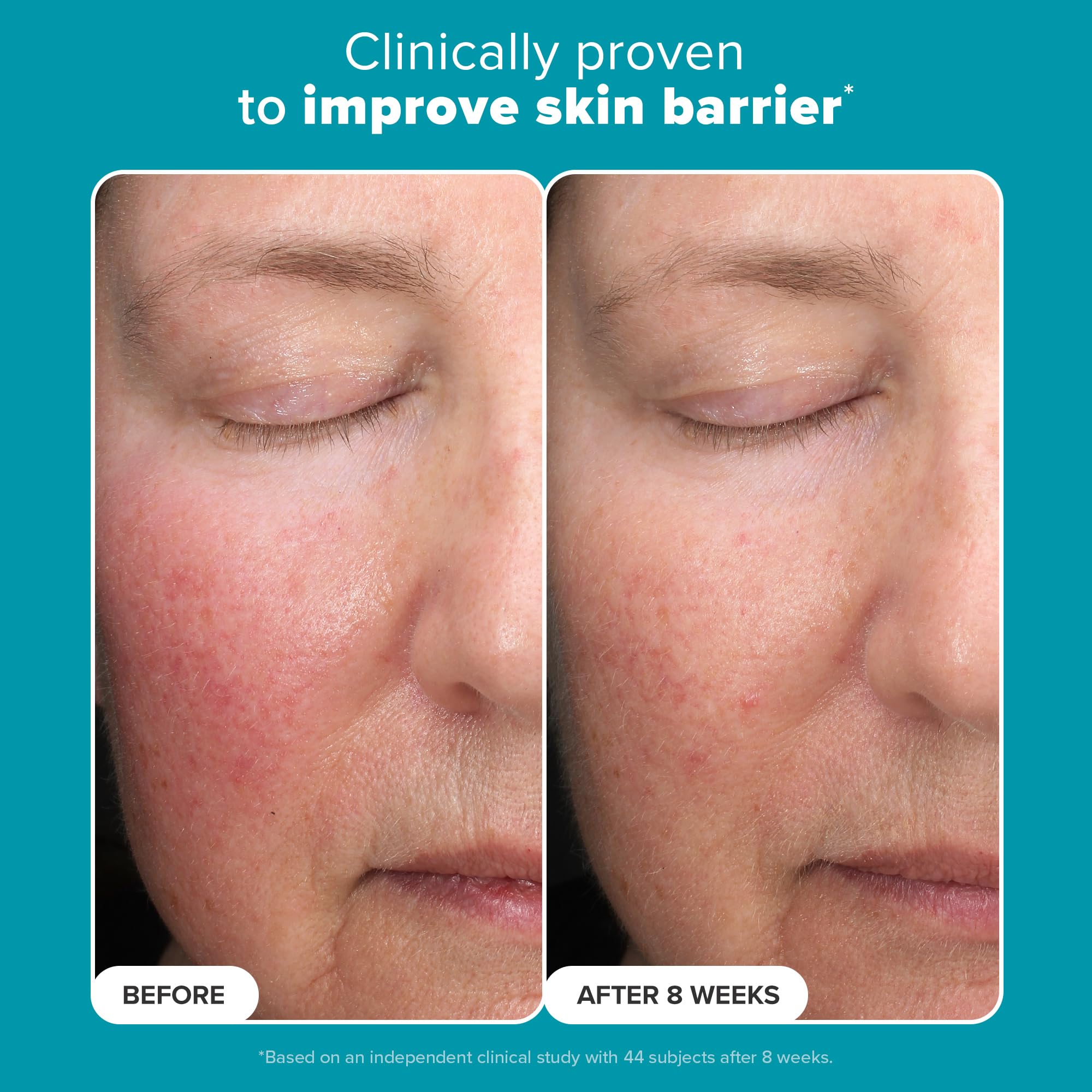 Fragrance-free Paula's Choice exfoliant ideal for sensitive skin