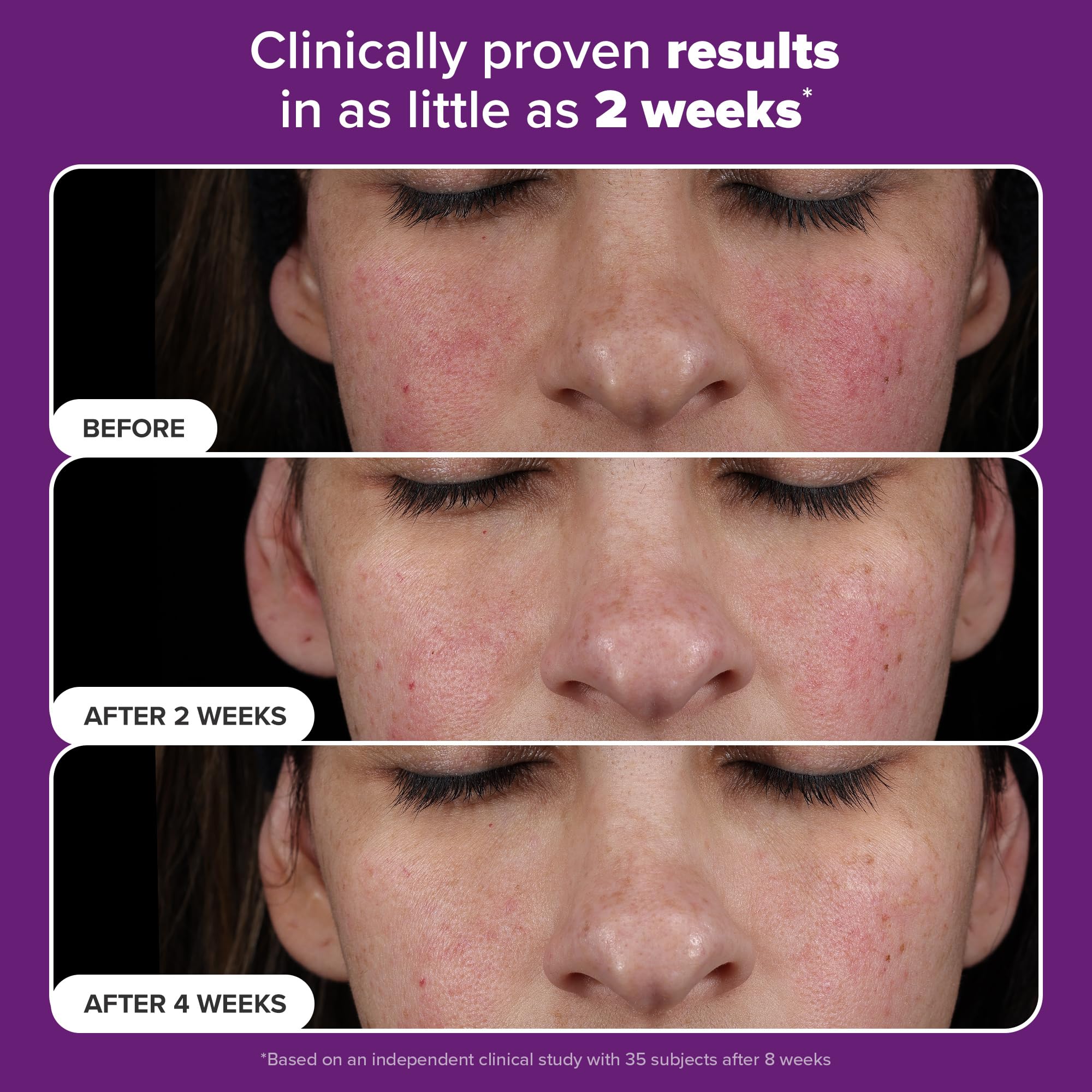 Paula's Choice Pro Retinaldehyde dual-retinoid cream texture depicts rich, smoothing skincare for daily use
