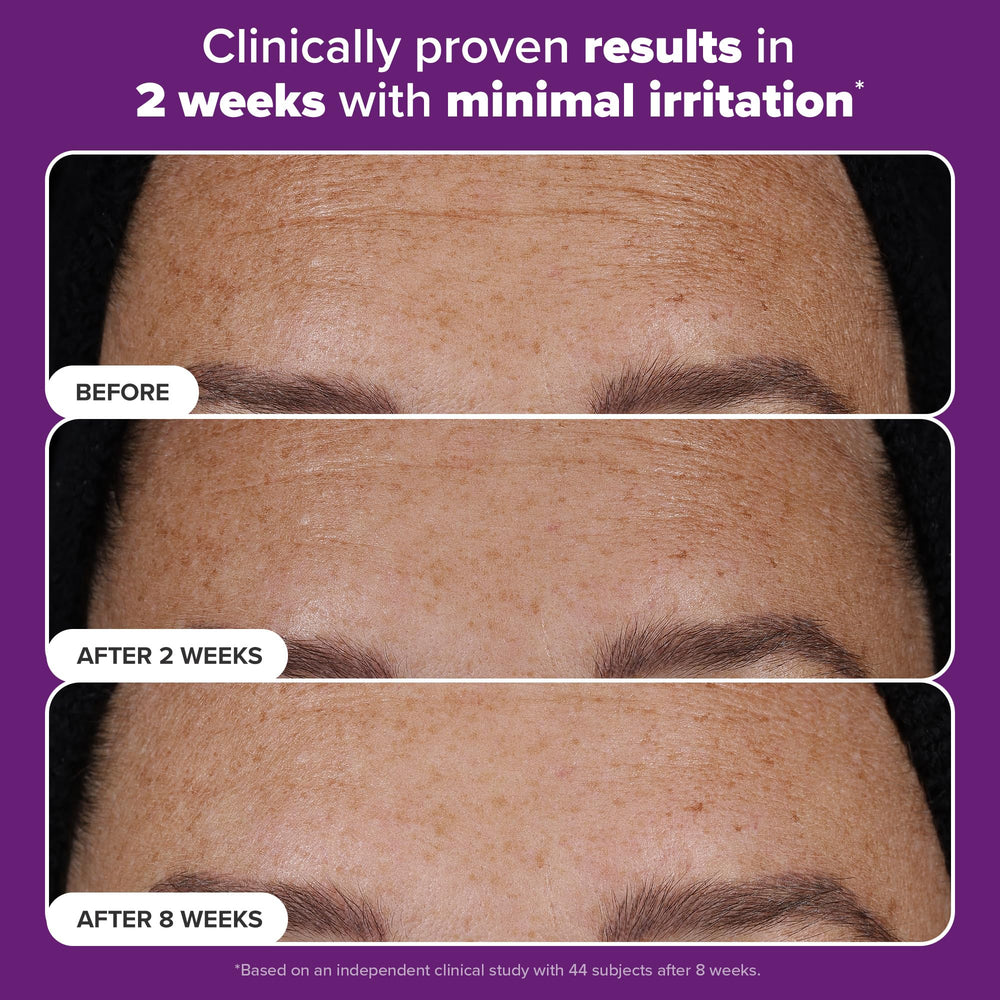 Paula's Choice Pro Retinaldehyde encapsulated-release graphic suggests gentler retinoid experience