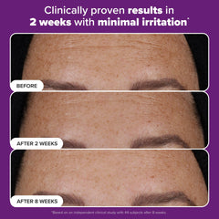 Paula's Choice Pro Retinaldehyde encapsulated-release graphic suggests gentler retinoid experience