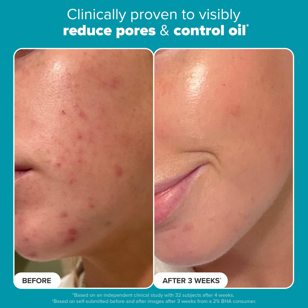 Paula's Choice Skin Perfecting 2% BHA swatch on skin for even tone.
