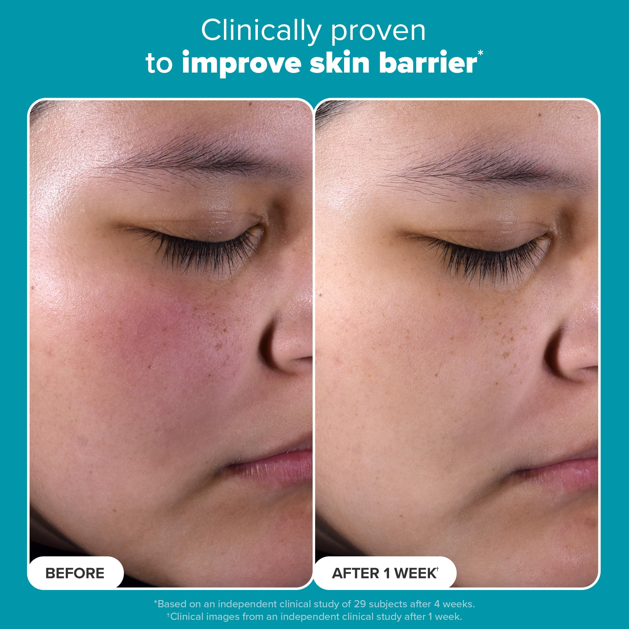 Application on cheek image hints at daily routine for clearer, even-toned skin.