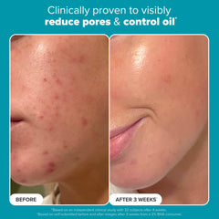 Paula's Choice exfoliant texture closeup—gentle exfoliation and even tone.