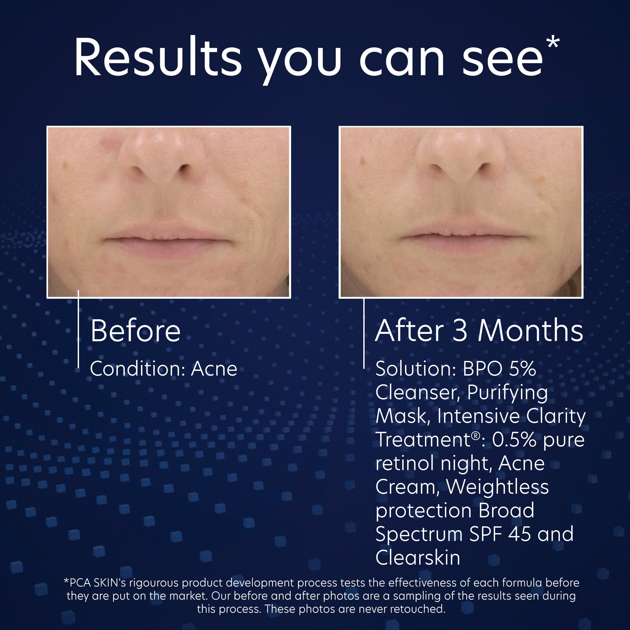PCA SKIN skincare routine with moisturizer after wash