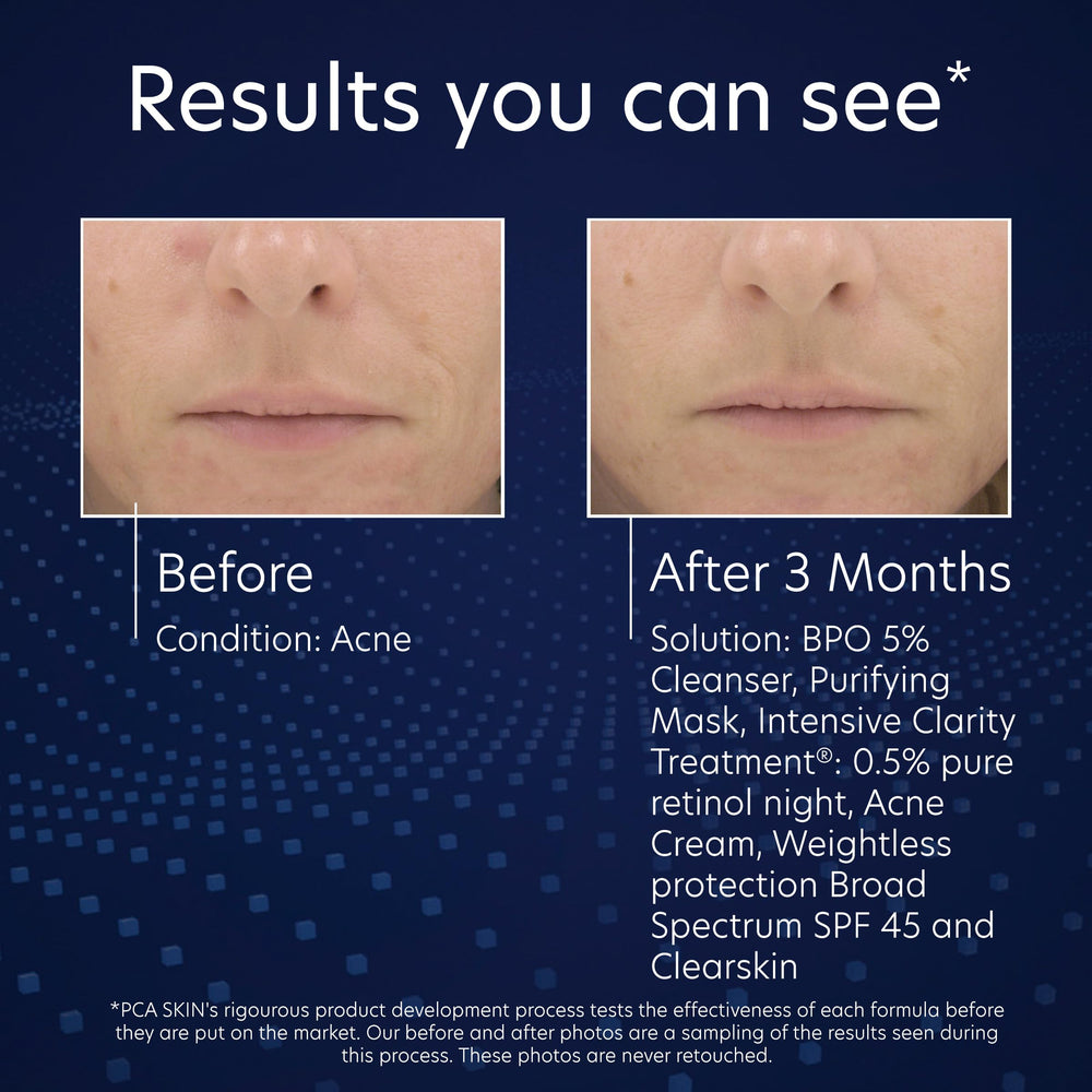 PCA SKIN skincare routine with moisturizer after wash