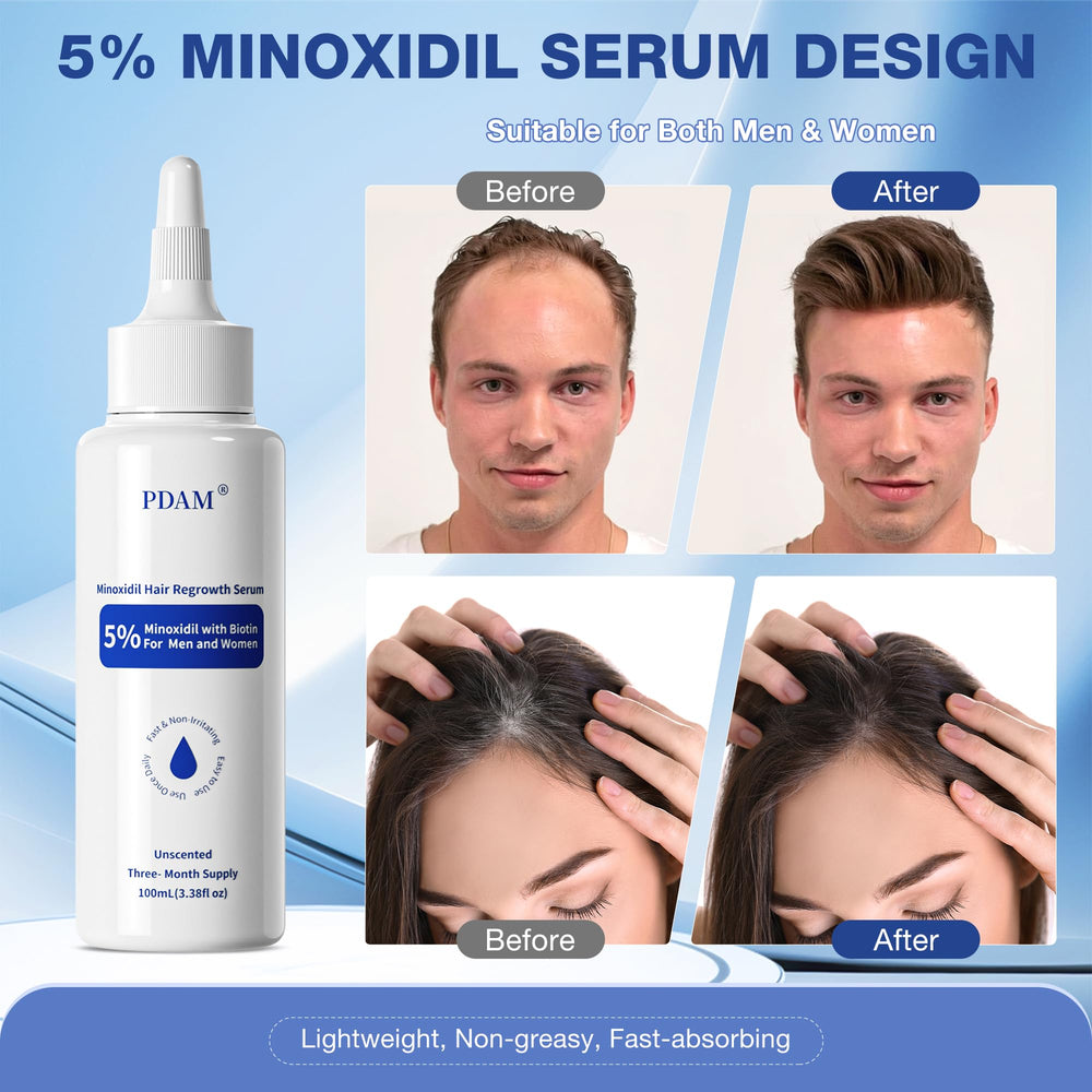 Pdam Minoxidil beard application massaged into skin