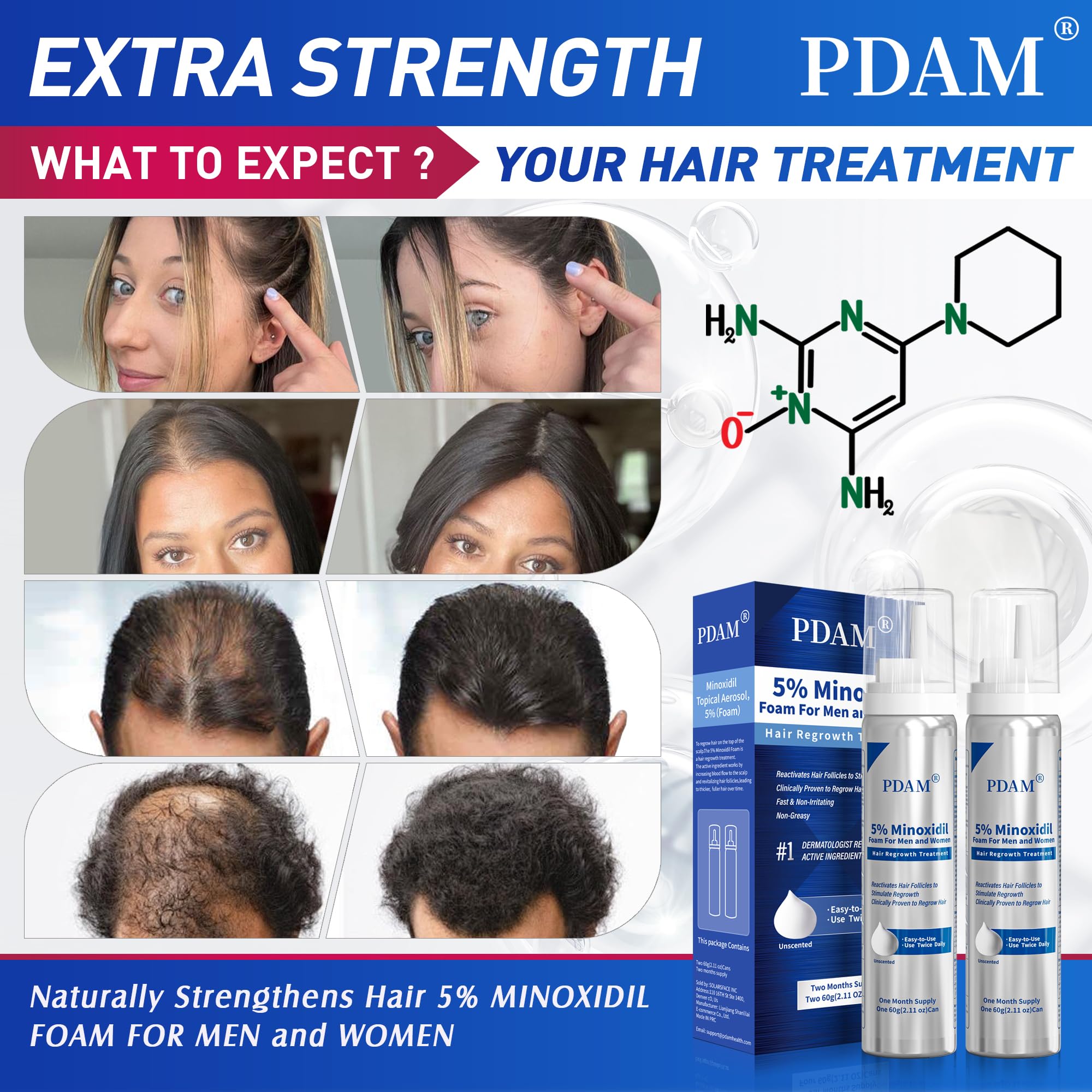 Pdam Minoxidil foam beard-growth showing thicker facial hair over time.
