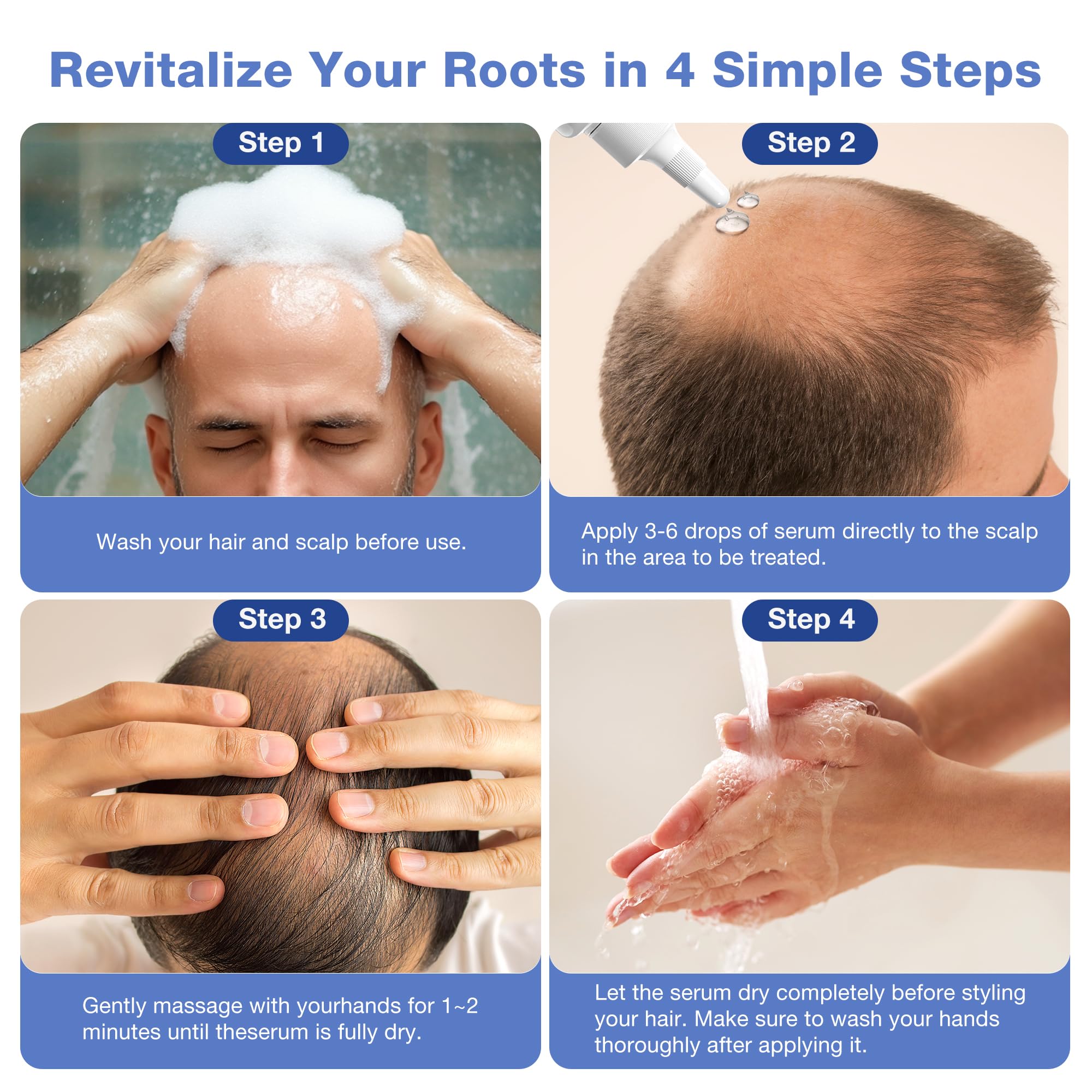 Pdam Minoxidil for men bottle emphasizes versatile use