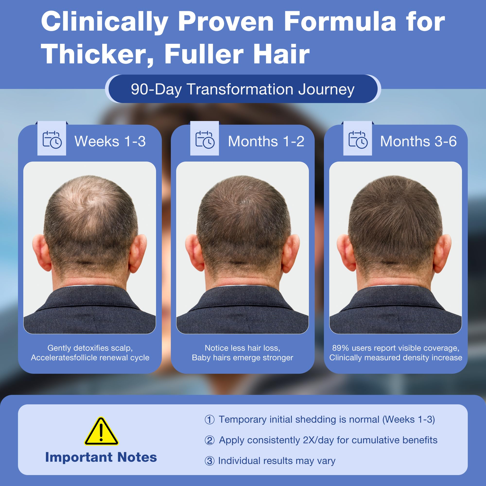 Pdam Minoxidil scalp density close-up suggests fuller look