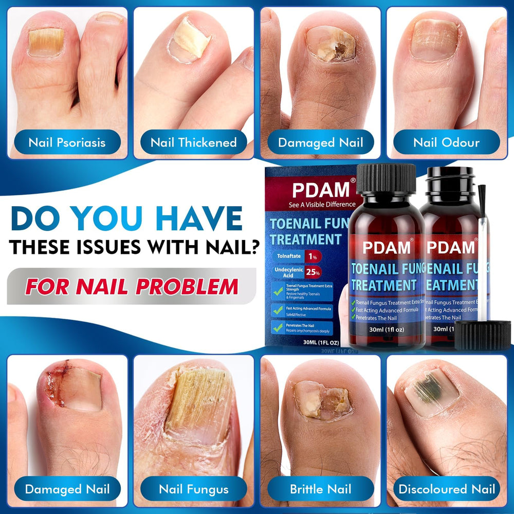 PDAM toe nail fungus treatment being applied to nail—targeted surface application for faster absorption.