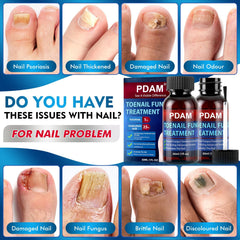 PDAM toe nail fungus treatment being applied to nail—targeted surface application for faster absorption.