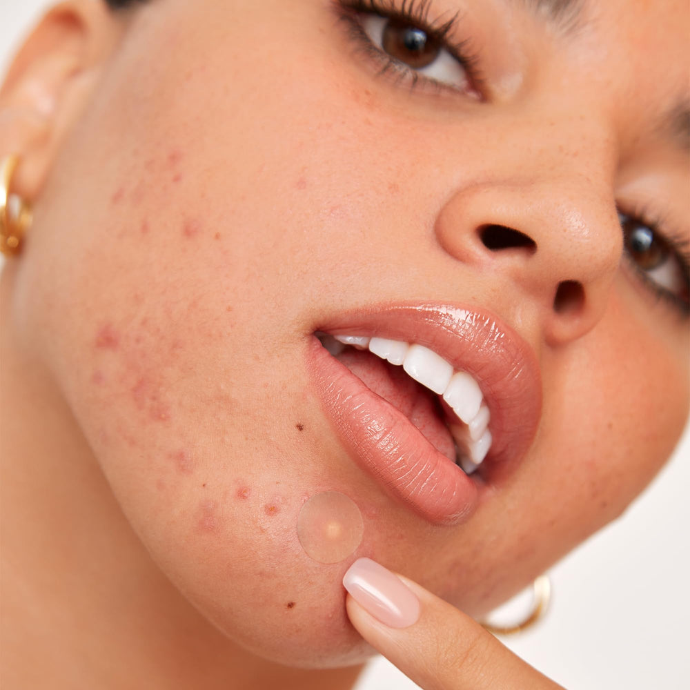 PEACE OUT Acne Healing Dots packaging with patches illustrates easy daily use.