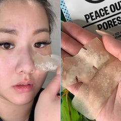 Peace Out Skincare hydrocolloid strips closeup highlighting absorption and cleansing action