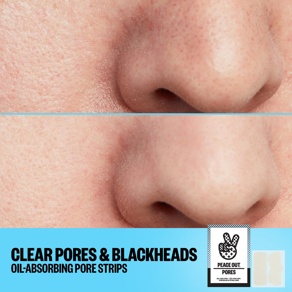 Peace Out Skincare peel-off strip demonstrates removal action and pore cleansing