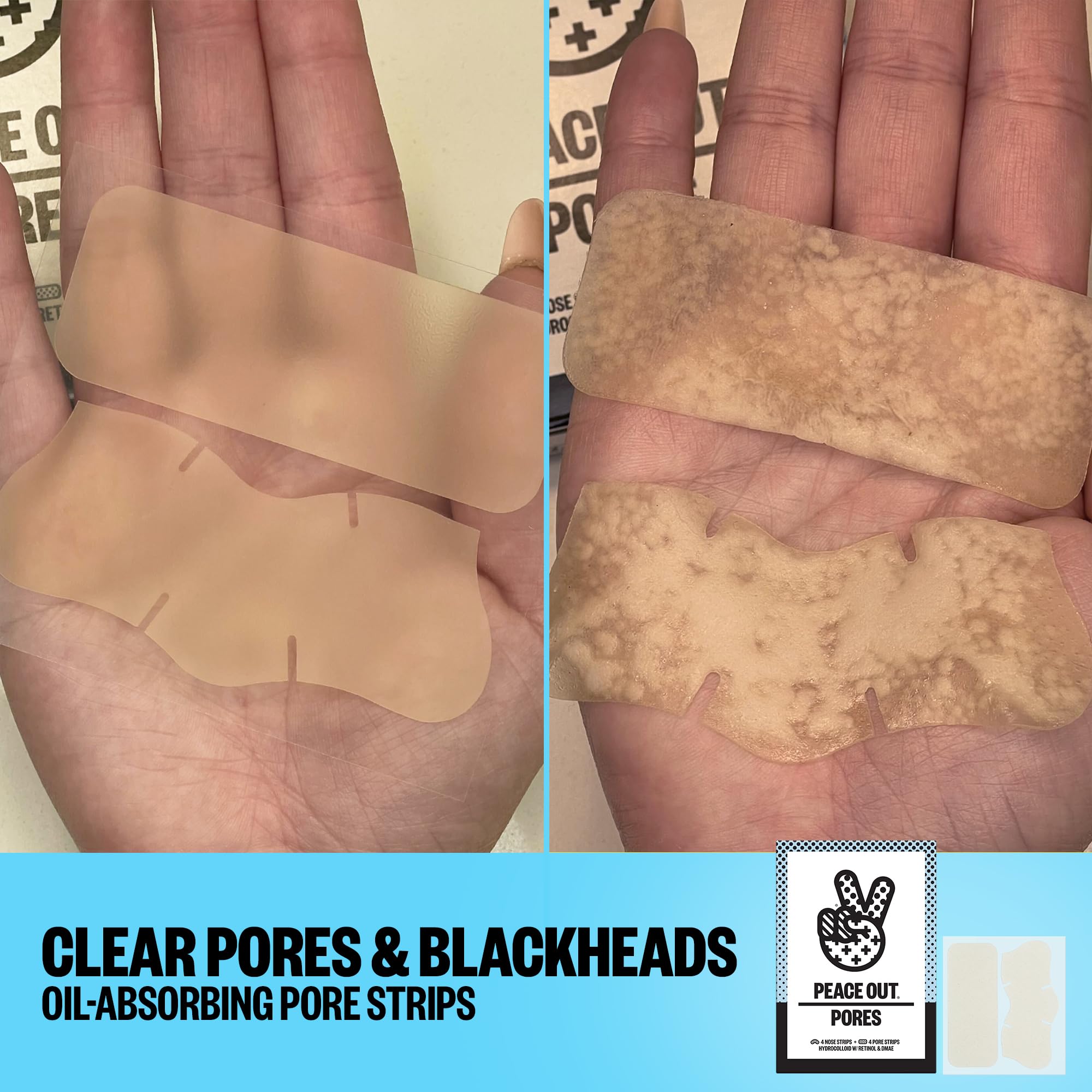 Peace Out Skincare set of eight strips shown together for full nose and pore care