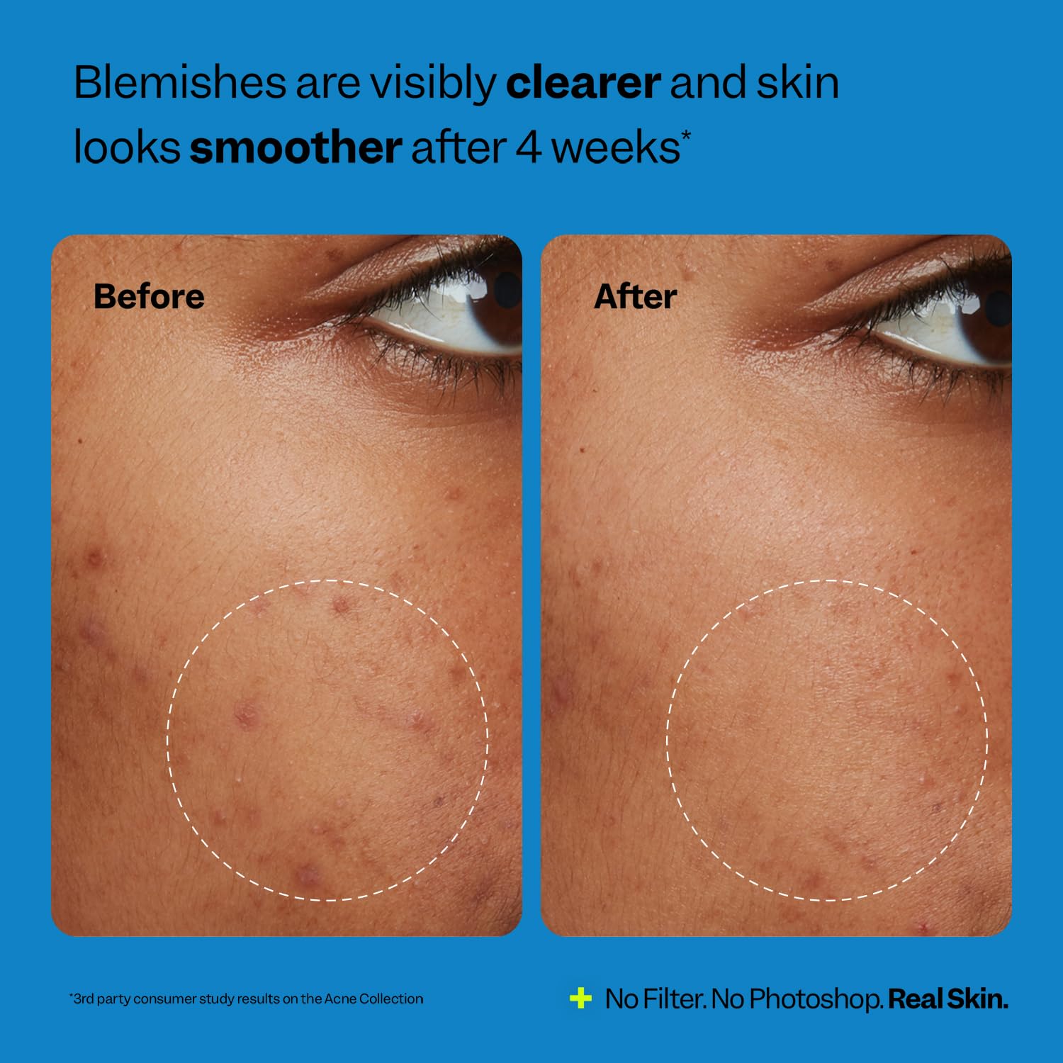 Peach Slices Acne Oil-Free Moisturizer acerola antioxidant image signals calming benefits.