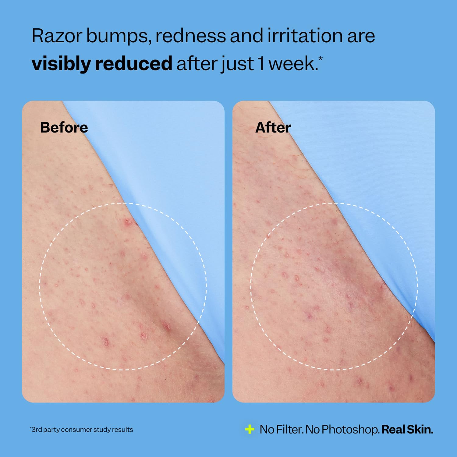 Peach Slices smoothing-solution on leg after shaving for smoothness