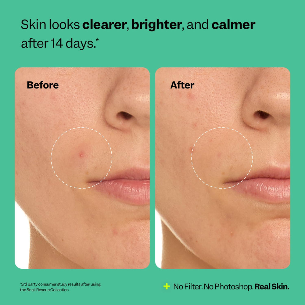 Peach Slices Snail Rescue Purifying Cleanser cica plant imagery—soothing skin routine.