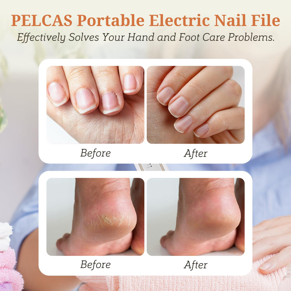 Pelcas cordless nail file features long battery life for at-home care.