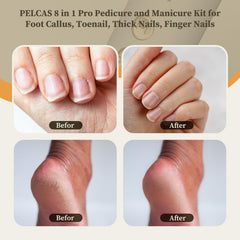 PELCA S electric nail file with 5 speeds for natural nails and thick cuticles.