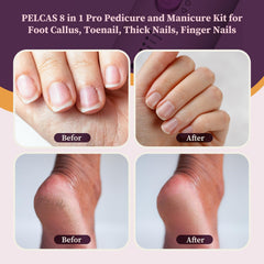 Pelcas electric nail file with LED light for precise filing.