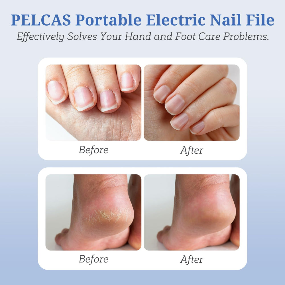 PEL CAS nail drill bits collection shown for versatile nail care tasks.