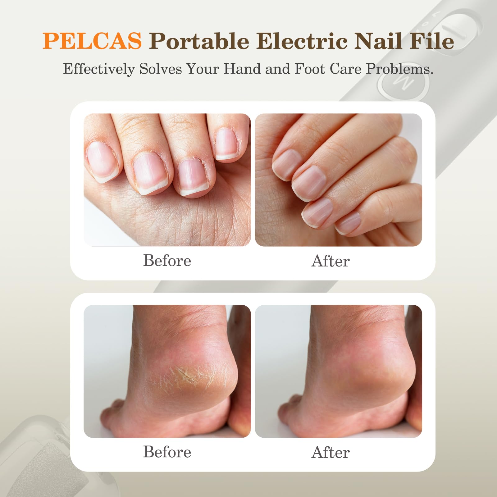 Pelcas nail drill with 360 lighting for clear visibility during grooming.