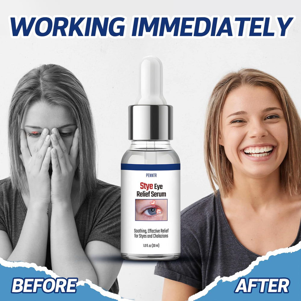 PENNTR Stye Eye Serum helichrysum flower infusion notes