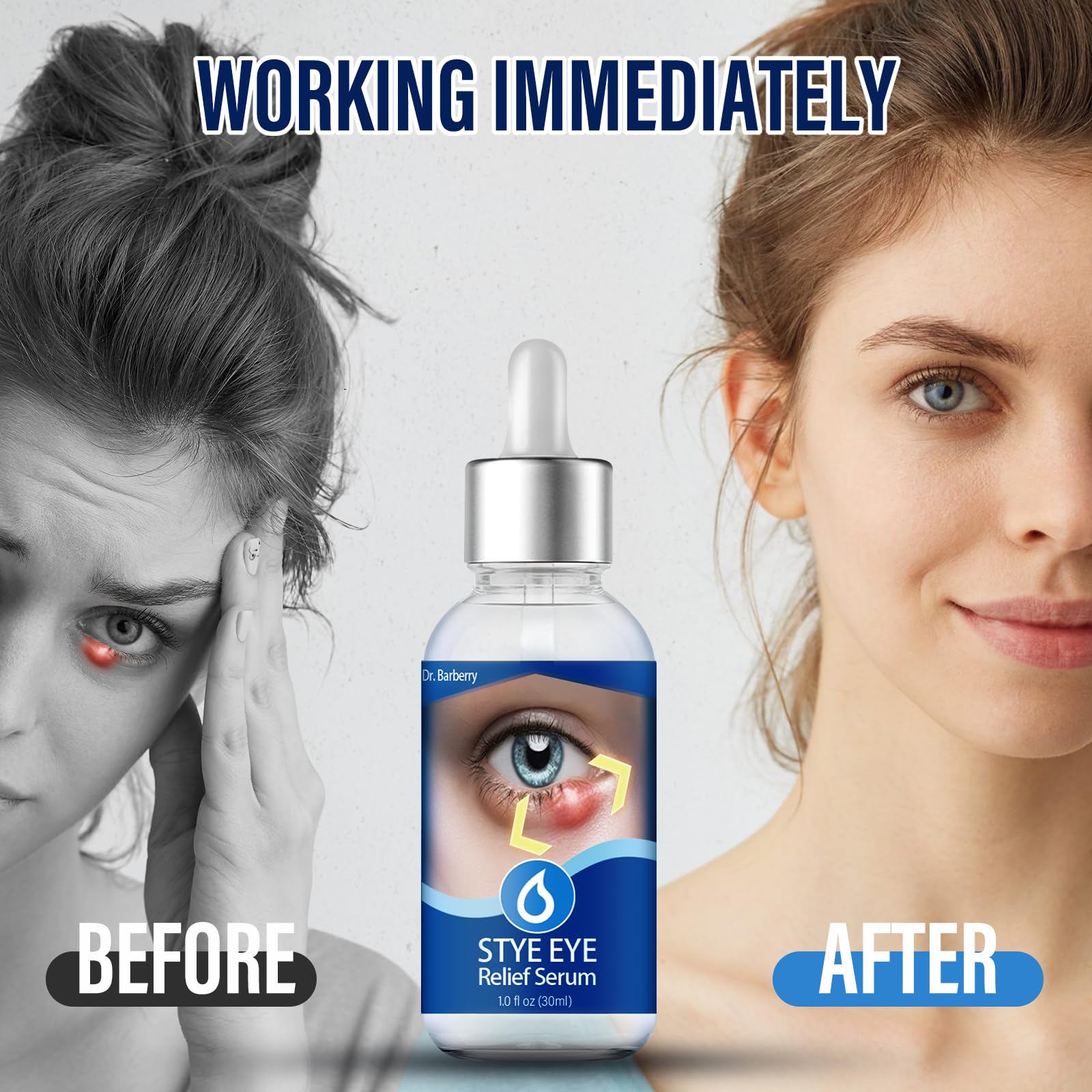 PENNTR Stye Eye Treatment routine shown for soothing eye comfort.