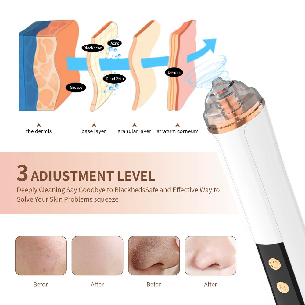 PENSVOX Blackhead Remover USB rechargeable for portable skincare on the go.