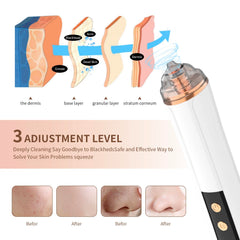 PENSVOX Blackhead Remover USB rechargeable for portable skincare on the go.