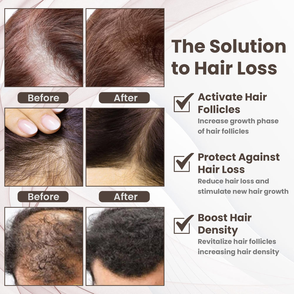 PeptideLabz Scalp massage in circular motion demonstrates simple self-care routine.