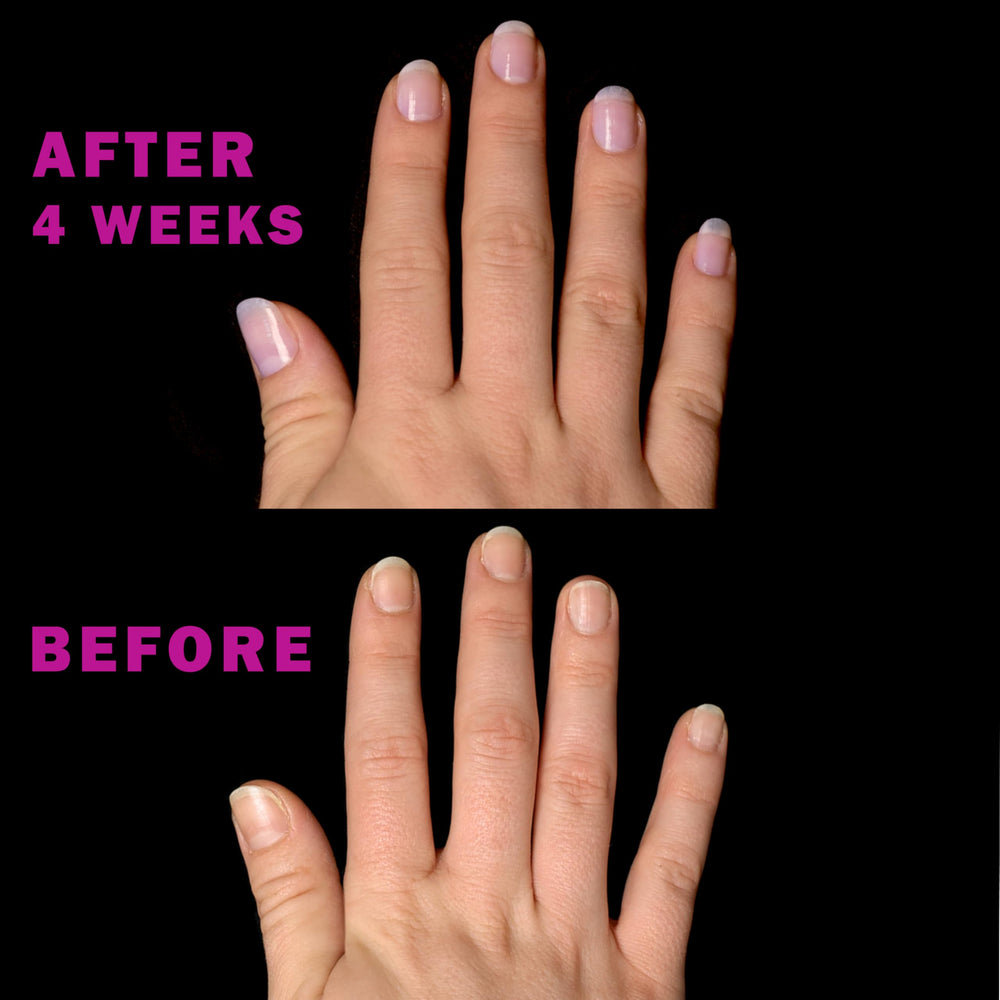 Perfect Formula Nail Essentials Kit Keratin Nail Treatment supports healthier nails at home