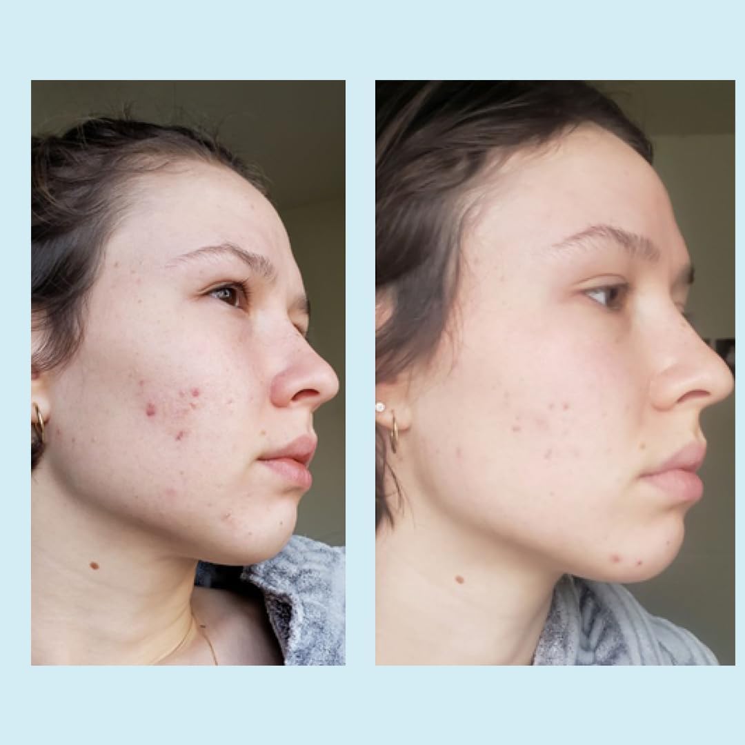 Perfect Image Glycolic 50% Gel Peel label shows concentration and usage guidance.