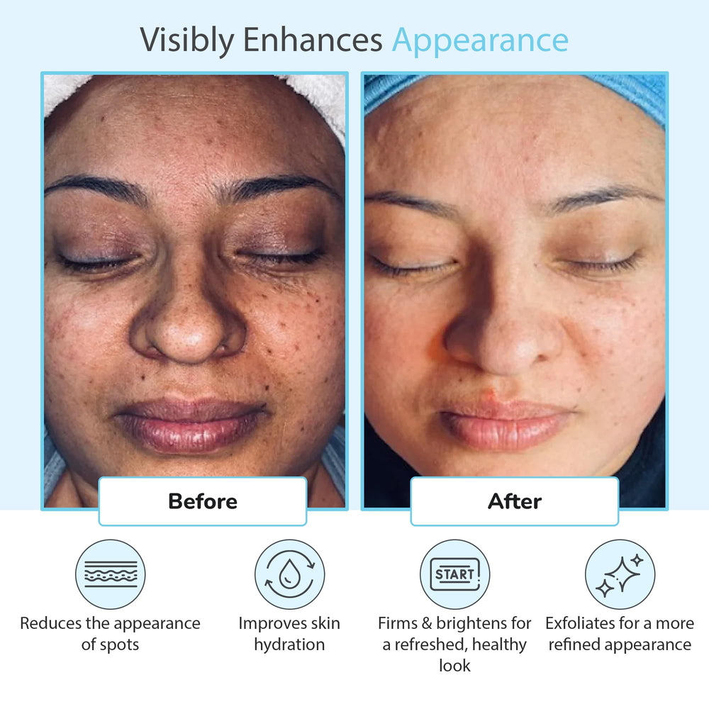 Perfect Image Glycolic 50% Gel Peel side-view bottle signals professional use.