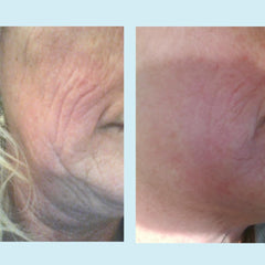 Bearberry and licorice extracts in Perfect Image peel for natural brightening