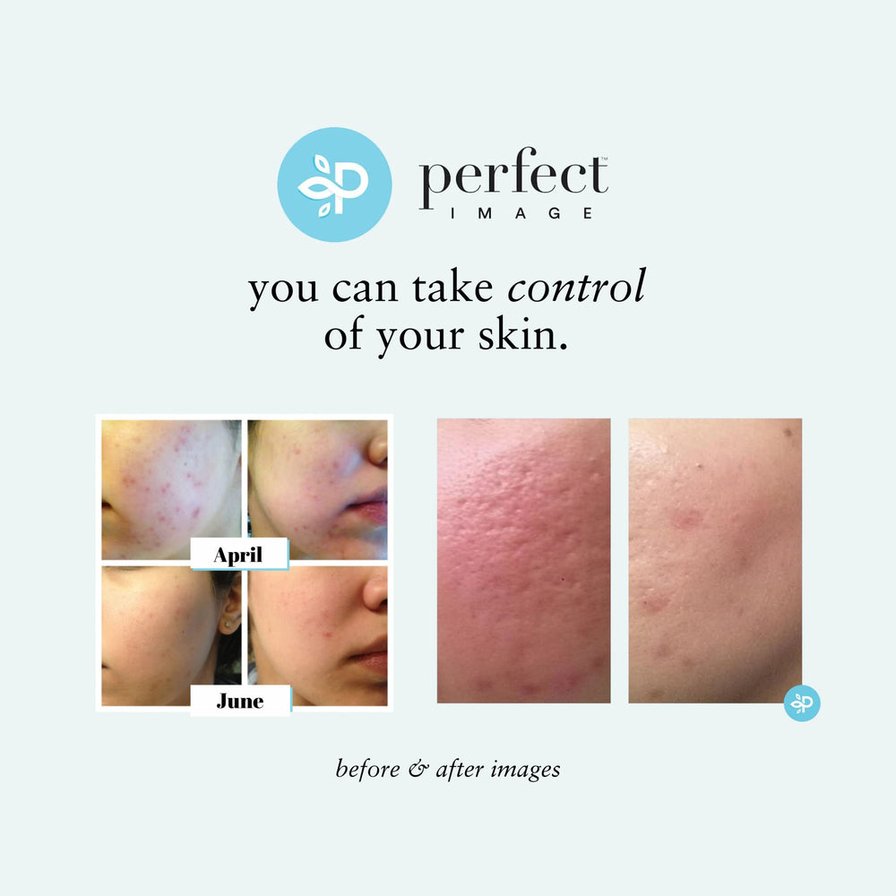 Packaging box of Perfect Image Lactic 50% Gel Peel
