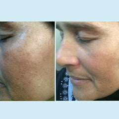 Close-up of gel texture from Perfect Image Lactic Peel