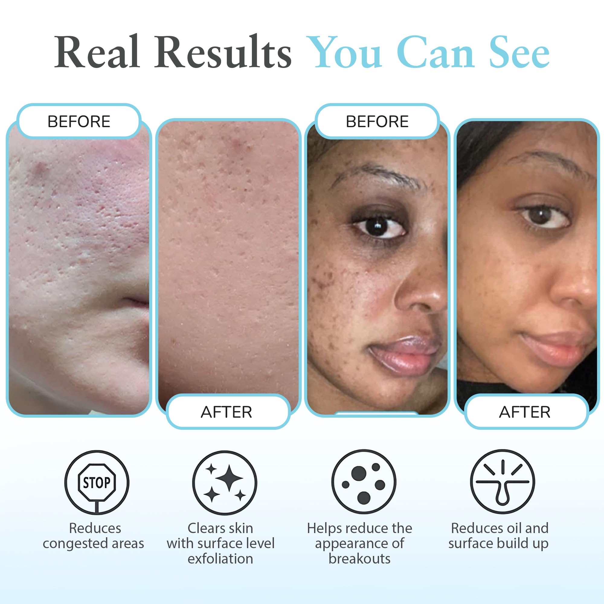 Perfect Image Salicylic 10% Gel Peel pump highlights easy, precise application.