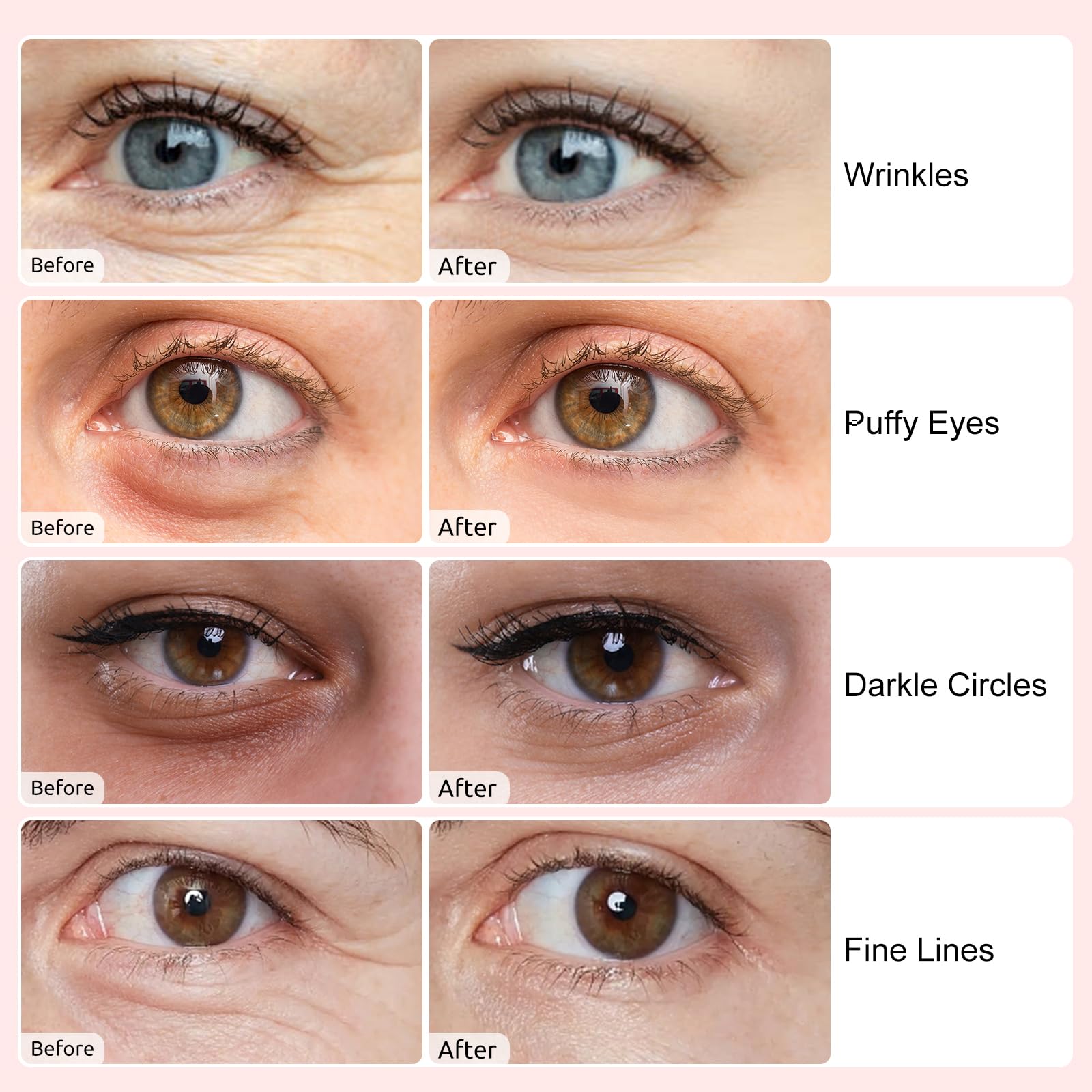 Permotary eye patches soothe puffiness and soften fine lines around the eyes.