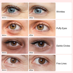 Permotary eye patches soothe puffiness and soften fine lines around the eyes.
