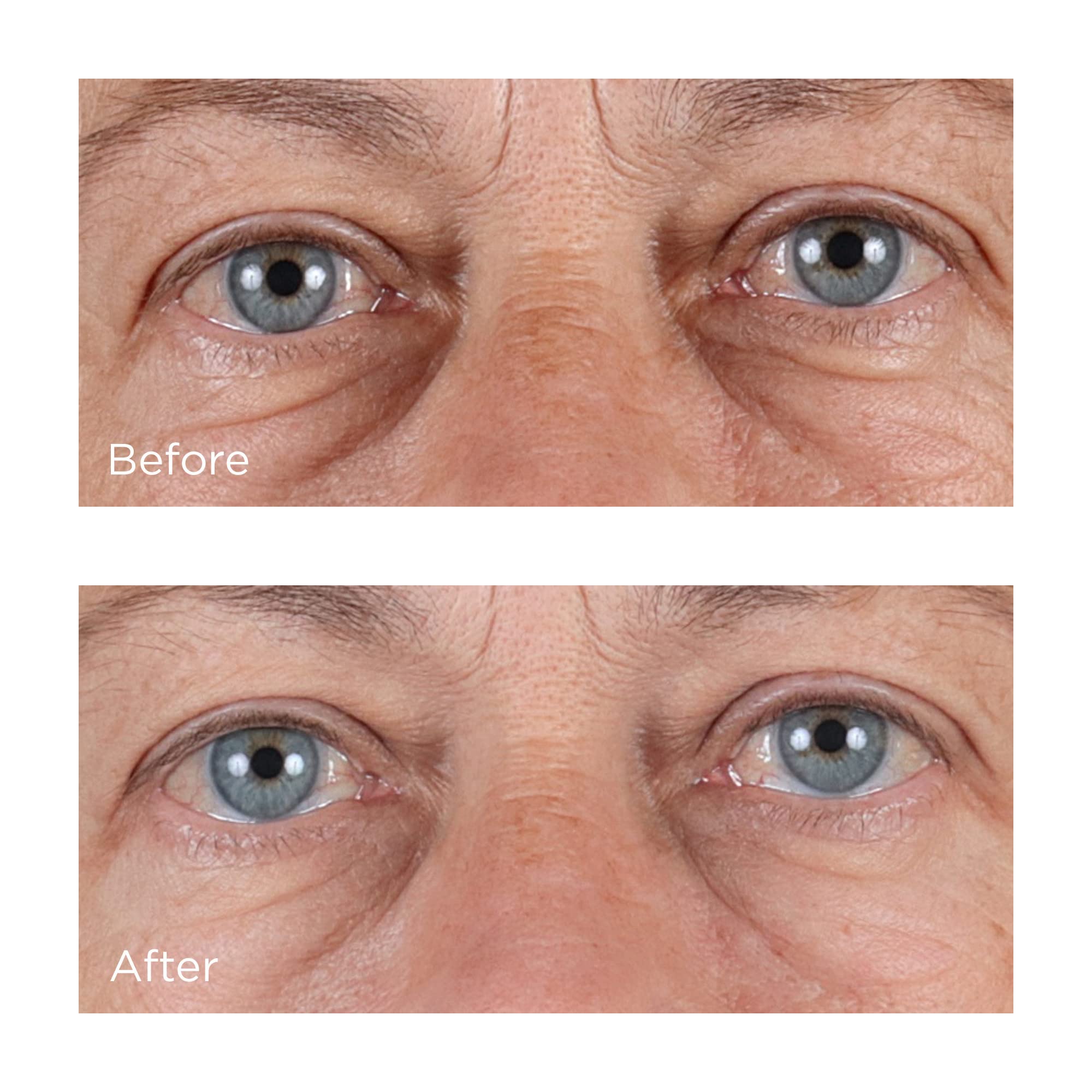 Perricone MD DMAE firming ingredient closeup suggests lifting and support over time.